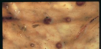 Horse owners still using the wrong wormer for encysted small redworm